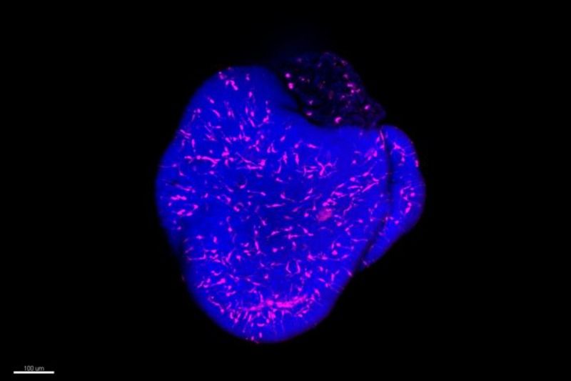  Mikroglia im Mini-Gehirn Organoide sind essenziell in der Forschung, da sie menschliche Organe nachahmen und für die Modellierung von Krankheiten, Medikamententests und das Verständnis von Entwicklungsprozessen genutzt werden.  Ein Forscherteam am ISTA hat ein neues Gehirn-Organoid-Modell mit integrierten Mikroglia vorgestellt. Diese speziellen Zellen reagieren auf Virusinfektionen mit Entzündungsreaktionen. Das Modell ermöglicht die Erprobung von Entzündungsbehandlungen, wie Ibuprofen, dessen schützende Wirkung in der Embryonalentwicklung erforscht wurde.  Während Mikroglia in simulierten virusinfizierten Organoiden Entzündungen zeigten, half Ibuprofen, diese zu reduzieren und das neuronale Gleichgewicht wiederherzustellen. Dies verdeutlicht, wie wichtig realistische Organoid-Modelle mit Mikroglia für zukünftige Forschungen und Medikamententests, insbesondere für Schwangere, sind. Das Bild zeigt Mikroglia (in Magenta), die in ein Retina-Organoid integriert sind.  Die Zellkerne der Neuronen sind in Blau gefärbt. Hier gehts zur Originalmeldung Wissenschaftsbild des Tages vom 15.4.2025  (Bild: Schmied et al. / Journal of Neuroinflammation)
