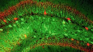 Blick ins Gedächtnis: Die Nervenzellen leuchten in der Videoaufnahme des speziellen Mikroskops auf, sobald sie aktiviert werden. (Thomas Hainmüller, Marlene Bartos, Nature)