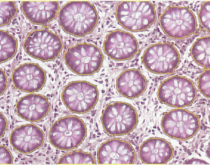 3 Automatisches Finden von gesuchten Zellarealen mit der AxioVision Software.  (Bild: Carl Zeiss MicroImaging GmbH)