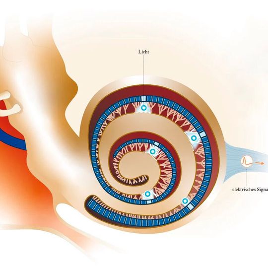 Ein optogenetisches Cochlea-Implantat übersetzt akustische Reize in Lichtpulse. Feine lichtleitende Fasern (blau) leiten die Pulse ins Innenohr: hohe Töne an die Basis, tiefere Töne weiter an die Spitze der Hörschnecke. Mit molekularen Lichtsensoren ausgestattete Nervenzellen des Hörnervs wandeln die Lichtpulse in elektrische Signale um und leiten sie zur weiteren Verarbeitung ins Gehirn. Ein optogenetisches Cochlea-Implantat übersetzt akustische Reize in Lichtpulse. Feine lichtleitende Fasern (blau) leiten die Pulse ins Innenohr: hohe Töne an die Basis, tiefere Töne weiter an die Spitze der Hörschnecke. Mit molekularen Lichtsensoren ausgestattete Nervenzellen des Hörnervs wandeln die Lichtpulse in elektrische Signale um und leiten sie zur weiteren Verarbeitung ins Gehirn.