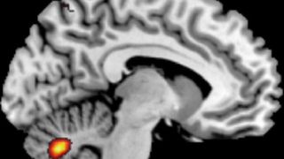 Aktivierung von spannungsabhängigen Ionenkanälen im Kleinhirn (Bild: MCN)