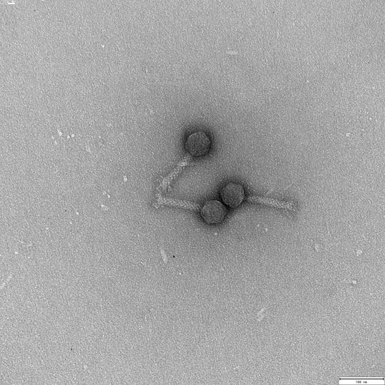 Bakteriophagen – also Viren, die Bakterien befallen – haben üblicherweise einen sogenannten Kopf und einen Schwanz, von dem wie Beinchen kleine Spikes abstehen. Die Viren namens Peternella auf diesem Bild aus dem Elektronenmikroskop sind etwa 150 nm lang, also etwa 500 mal kleiner als die Dicke eines menschlichen Haars. (Bild:  © Georg Krohne)