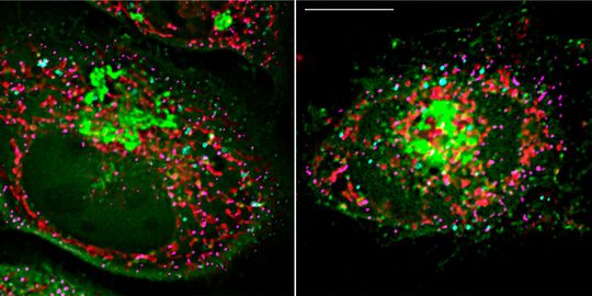 Two fluorescent microscopic images: At the contact site between mitochondrion (red) and lipid droplet (turquoise), the protein Arf1 (green) ensures that lipids are shuttled into the mitochondria, where they are converted into the energy donor ATP. Two fluorescent microscopic images: At the contact site between mitochondrion (red) and lipid droplet (turquoise), the protein Arf1 (green) ensures that lipids are shuttled into the mitochondria, where they are converted into the energy donor ATP.