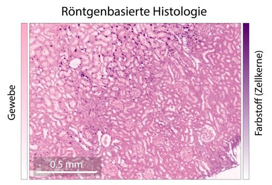 Für Röntgenbilder ungewöhnlich: Statt in Schwarzweiß erscheinen die Strukturen der untersuchten Mausniere im Histologie-Farbschema. Zellkerne sind hierbei in Violett hervorgehoben, während das restliche Gewebe in Pink dargestellt wird. Das sind wertvolle Informationen für die Diagnostik.(Bild:  Hereon/Dominik John)