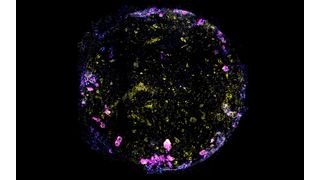 Image of the lung-on-chip, with cell nuclei in blue, macrophage in magenta, endothelial cells in yellow and tight junctions between epithelial and endothelial cells in white. (Source: Jakson Luk, Science Advances)