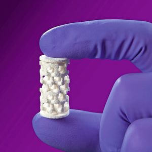 Aus einer speziellen Keramik entsteht an der Bundesanstald für Materialforschung resorbierbarer Knochenersatz.