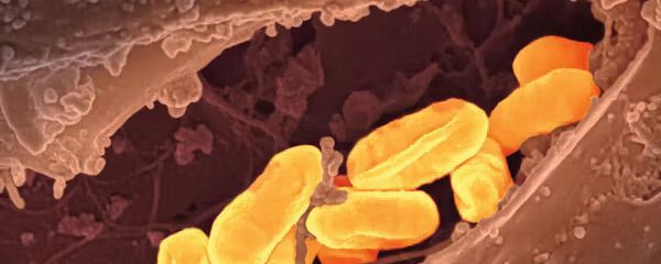 Die Darm-Immunsystem-Interaktion ist bislang immer noch ein Rätsel für Wissenschaftler. Es ist klar, dass gute Bakterien Infektionen verhindern können, doch im Darm leben auch Bakterien, die bei Eintritt in den Körper gefährlich werden können. Eine selektive Bekämpfung pathogener Keime ist daher besonders wichtig. (Symbolbild) (Bild:  frei lizenziert, National Institute of Allergy and Infectious Diseases / Unsplash)