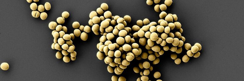 Rasterelektronenmikroskopische Aufnahme des Epifadin produzierenden Bakteriums Staphylococcus epidermidis. Kolorierung: Elke Neudert/Universität Tübingen.(Bild:  © Jeremiah Shuster, Tübingen Structural Microscopy Core Facility / Arbeitsgruppe Geomikrobiologie / Universität Tübingen)