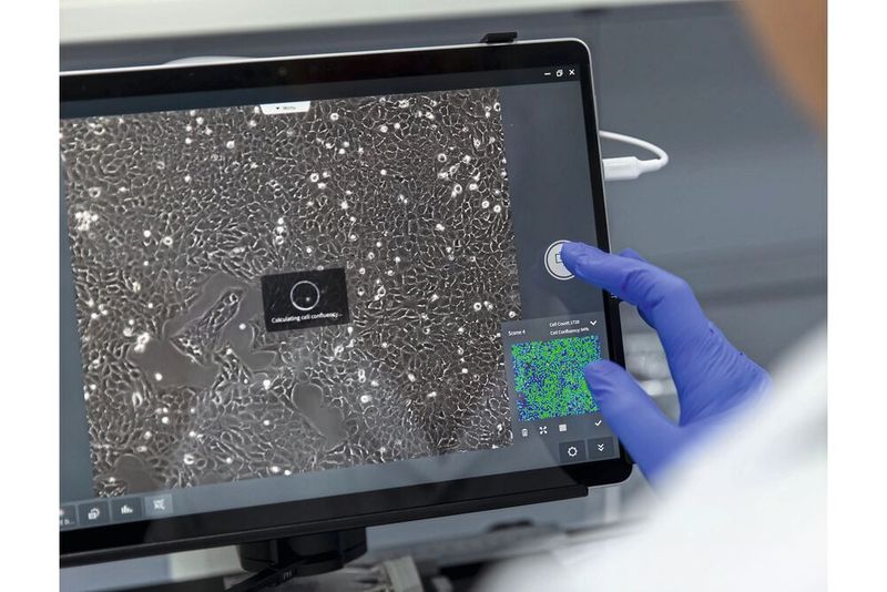 Abb.4: Ergebnisse der Zellzählung auf Knopfdruck – mittels KI (Bild: Carl ZEISS Microscopy)