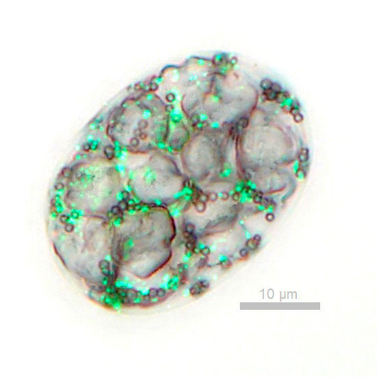 Zelle des Bakteriums Achromatium oxaliferum unter dem Mikroskop. Man erkennt große Calciumkristalle, Schwefeltröpfchen sowie grün fluoreszierende DNA-Spots. (Heribert Cypionka / Universität Oldenburg)