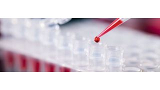 Abb. 1: Ob PCR, Verdünnungsreihe oder ELISA – Pipettieren gehört zu den wesentlichen Routine-Aufgaben im Labor. Präzision ist hier oberstes Gebot. (© science photo – stock.adobe.com)