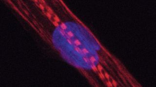 Humane Muskelzelle. Bei Menschen, die Statine nehmen, war u.a. die Produktion von Myosinen gestört. Diese Proteine sind im Bild rot angefärbt, der Zellkern blau. Die Querstreifen zeigen, dass die Zelle sich in eine reife Muskelfaser entwickelt. (Bild: Andreas Marg, MDC)