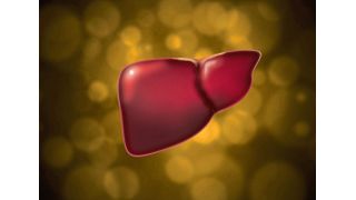 Die so genannte nichtalkoholische Fettleber kann sich zu einer lebensbedrohlichen Erkrankung entwickeln (Symbolbild). (gemeinfrei, GCMpublicitat, killy555)