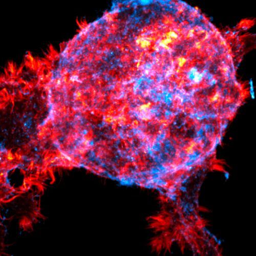 Breast cancer cells break through the basement membrane acting as a biological barrier. In the image, the finger-like projections formed by the actin of cancer cells invading the surrounding cell medium are coloured red and the basement membrane protein is coloured blue. 
