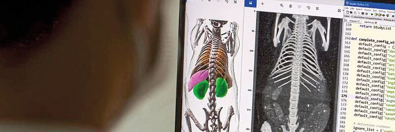 Dank Künstlicher Intelligenz ist die Aimos-Software in der Lage, auf dreidimensionalen Graustufenbildern Knochen und Organe zu segmentieren, was die anschließende Auswertung erheblich erleichtert.