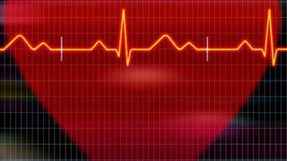 Atrial fibrillation is the most common heart rhythm disorder, affecting more than 40 million people worldwide.  (Source: Pixabay)