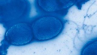 Das Bakterium Pseudomonas aeruginosa kann unter anderem Lungenentzündungen, Harnwegs- und Hautinfektionen hervorrufen. (Bild: HZI)