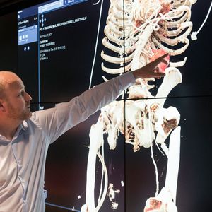 Eine fotorealistische Darstellung des Körperinneren ermöglichten die Forscher bei Siemens Healthineers. Sie nahmen sich die Filmtechnik zum Vorbild und entwickelten auf dieser Basis die neue medizinische Visualisierungstechnologie: Animierte Figuren, wie beispielweise Gollum aus der „Herr der Ringe“, wirken im Film völlig natürlich und nicht wie Fremdkörper, obwohl sie zunächst digital modelliert und erst nachträglich in die Szenen eingefügt wurden.