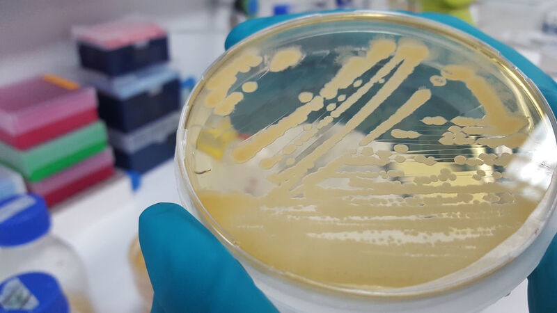 Bakterienkultur in einer Petrischale: Bestimmte bakterielle Krankheitserreger verändern den Stoffwechsel in Essigfliegen derart, dass eine erhöhte Produktion von Pheromonen die Folge ist. (Ian W. Keesey, MPI chem. Ökol. )