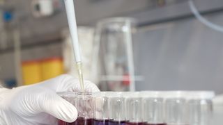 Das Team um Kristina Tschulik entwickelte daher eine Methode, mit der sich einzelne Silberpartikel in natürlicher Umgebung untersuchen lassen.  (© RUB, Kramer  )