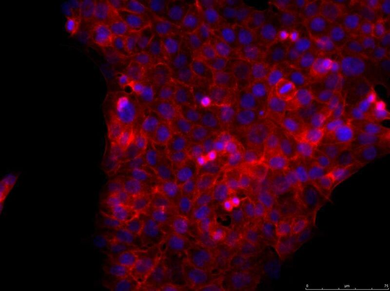 Tumorzellen im Zellverband.  (Bild: Johannes Fritzmann/MDC)