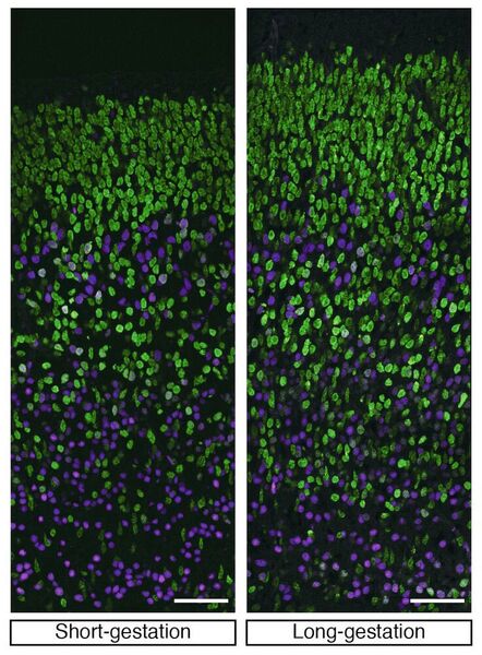 Nervenzellen in den tiefen (Magenta) und oberen (grün) Neokortex-Schichten bei Mäusen mit kurzer (l.) und langer (r.) Tragezeit. Man erkennt die Nervenzell-Zunahme in den oberen Schichten im Mausembryo mit langer Tragezeit. Maßstab: 50 µm. (Stepien, Vaid, Huttner / MPI-CBG)