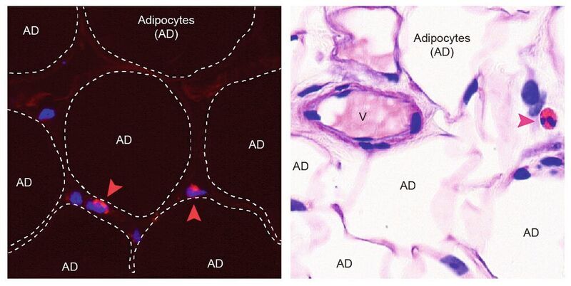 Nachweis von Eosinophilen in menschlichem Bauchfett mittels zwei unterschiedlicher Färbungen. Die Eosinophile sind mit einer Pfeilspitze markiert. AD: Adipozyten (Fettzelle), V: Blutgefäß.  (© DBMR, Universität Bern, D. Brigger )