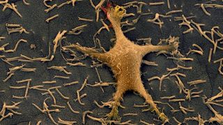 Siegerfoto des bundesweiten Fotowettbewerbs "Nano-Momente: „Wenn Hennen rennen“ (Kolorierte rasterelektronenmikroskopische Aufnahme) (Bild:  Clemens Tscheka, Michael Gepp, Nico Strack und Marc Schneider)