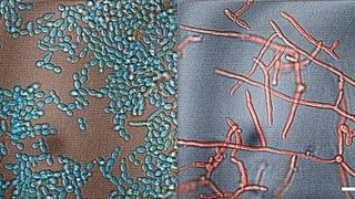 Candida albicans in seiner harmlosen (l.) und seiner infektiösen (r.) Form. Der weiße Balken entspricht 20 Mikrometern. (Bild: Julie Takagi et al., Nat. Chem. Biol. 2022, Koloration: Daniel Mathys, Universität Basel)