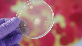 Klassische Analysenmethoden auf Antibiotikaresistenzen basieren auf mikrobiologischen Zellkulturen. Ein Nachteil ist, das diese recht zeitaufwändig sind. (© Gerhard Seybert, all rights reserved)