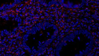 Das Protein Bcl-3 (rot) führt zu chronischen Entzündungen im Darm. (Johannes Gutenberg-Universität Mainz)
