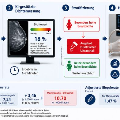Die Grafik zeigt den Ablauf eines dichteadaptierten Brustkrebs-Screenings: Auf die Mammografie folgt eine KI-gestützte Dichtemessung. Bei besonders hoher Brustdichte kann ein zusätzlicher handgeführter Ultraschall angeboten werden. Die Studie zeigt dadurch eine höhere Tumordetektion, allerdings auch eine höhere Biopsierate (Bild: KI-generiert nach [1,2] / Devicemed)