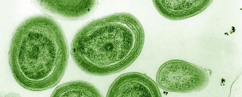 Elektronenmikroskopische Aufnahme von Prochlorococcus marinus(Bild:  Luke Thompson from Chisholm Lab and Nikki Watson from Whitehead, MIT – CC0)