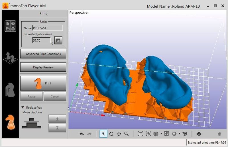 Der 3D-Scanner erfasst zuerst die Ohrmuschel und dann den Gehörgang. Die Bilder werden anschließend im Rechner verschmolzen, um ein digitales Modell des Ohrs zu erstellen. (Artec 3D)