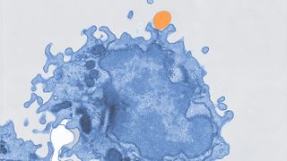 Immagine al microscopio elettronico con pseudocolorazione di un macrofago (blu) che ingloba microplastiche (arancione). (Bild: Mass Lab/Università di Bonn)