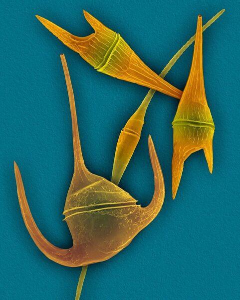 Coloured scanning electron micrograph (SEM) of Ceratium spp., one of the main types of phytoplankton being studied off Runde. (NTB scanpix Science Photo Library/ NTNU)