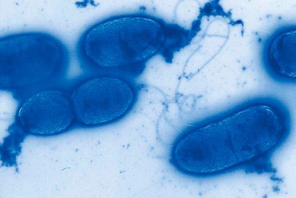 Das Bakterium Pseudomonas aeruginosa kann unter anderem Lungenentzündungen, Harnwegs- und Hautinfektionen hervorrufen. (Bild: HZI)