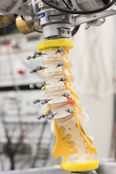 Um die Funktionsweise und Belastungsgrenze der Wirbelsäule und ihrer Bestandteile systematisch und hochpräzise zu untersuchen, wurde von Prof. Wilke bereits vor 25 Jahren einen Wirbelsäulenbelastungssimulator entwickelt.  (Elvira Eberhardt/Uni Ulm)