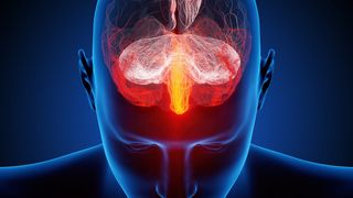 Laut einer Studie gibt es bei Projektmanagern ein deutlich höheres Risiko an Burnout zu erkranken als bei anderen Berufsgruppen. (JohanSwanepoel - Fotolia)