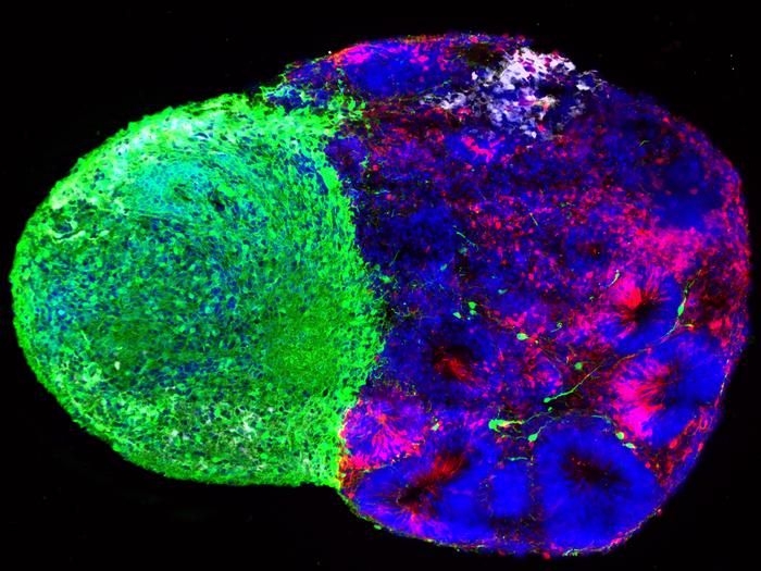 Bauanleitung im Gehirn  Während sich das menschliche Gehirn vor der Geburt formt, spielen spezielle Stammzellen eine entscheidende Rolle, so genannte radiale Glia. Sie treffen Milliarden von „Entscheidungen“, die bestimmen, welche Hirnzelltypen entstehen, wann sie erscheinen und wie sich der Kortex entwickelt – die Zentrale für Denken, Gedächtnis und Sprache.  Ein Forscherteam an der David Geffen School of Medicine der University of California hat diese Phase der frühen Hirnentwicklung und die Rolle der radialen Glia nun näher untersucht. Die veröffentlichten Studien zeigen: Gehirnentwicklung ist nicht passiv, sondern das Ergebnis aktiver, kontinuierlicher Kommunikation zwischen Stammzellen und ihrer Umgebung. Sowohl der Stoffwechsel als auch physikalische Verbindungen sind aktive Regulatoren der Stammzellentscheidungen während der frühen Hirnentwicklung.    Das Bild zeigt thalamische (grün) und kortikale (rot) Stammzell-abgeleitete Organoide. Diese sind verschmolzen, um zu untersuchen, wie Neuronen im Thalamus unreife kortikale Vorläuferzellen (radiale Glia, weiß) während der Gehirnentwicklung beeinflussen.    Hier geht‘s zur Originalmeldung Wissenschaftsbild des Tages vom 17.9.2026 (Bild: Claudia Nguyen, Aparna Bhaduri Lab)