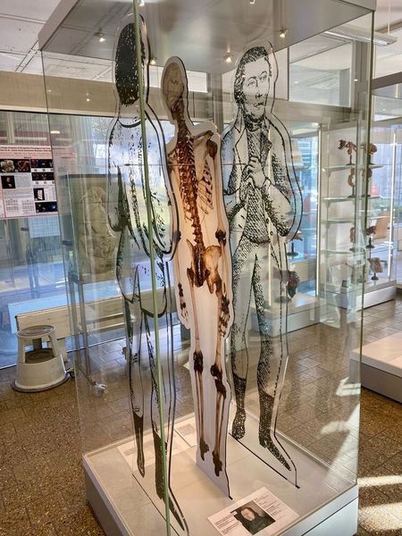 Eine Dauerausstellung zeigt unter anderem eine Replik des Skeletts des „Schinderhannes“ und eine künstlerische Darstellung seiner Person. Zu sehen ist die Anatomische Sammlung im Institut für Anatomie und Zellbiologie der Medizinischen Fakultät Heidelberg der Universität Heidelberg.  (Bild: MFHD )