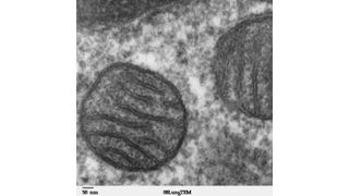 Elektronenmikroskopische Aufnahme von Mitochondrien. (Bild: Wikimedia Commons)