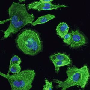 Diese Immunzellen exprimieren den HCA3-Rezeptor, der nur bei Menschanaffen und Menschen vorkommt. Kern und Cytoskelett sind gefärbt.