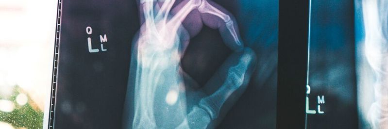 Bei den Geräten des Internets der medizinischen Dinge (IoMT) mit den meisten Sicherheitsproblemen handelt es sich vorwiegend um bildgebende Systeme.(Bild:  gemeinfrei / Unsplash)