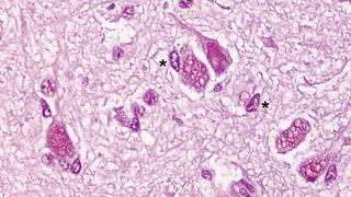 In der Färbung des etwa 245 Jahre alten Grönlandhai-Gehirns zeigen sich große Nervenzellen ohne Anzeichen pathologischer Veränderungen. Zudem fanden sich mutmaßliche Mikrogliazellen mit bohnenförmigem Zellkern und typischem Kernchromatin. Balken: 50 Mikro (Bild: Daniel Erny/Universitätsklinikum Freiburg)