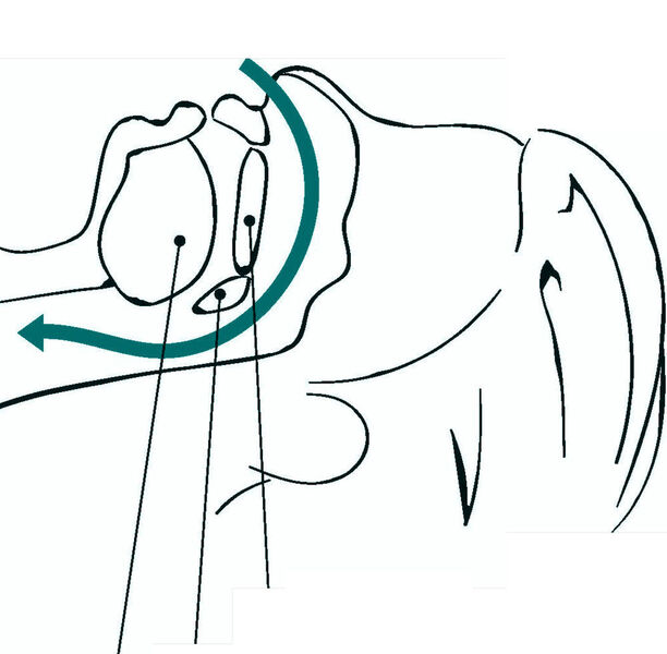 Zunge, Gaumensegel und Gaumen (an den Strichen von links nach rechts) – und der daraus resultierdende Luftstrom im Normalzustand, ...
 (Neuwirth Medicare)