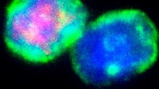 T-Zellen unter Kontrollbedingungen. Immunfluoreszenzfärbung von T-Zellen (grün: T-Zellmarker CD3, rot: Treg-Marker Foxp3, blau: Zellkern) (Ausschnitt) ... (Helmholtz Zentrum München)