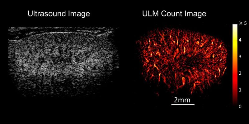 Ultraschall und Ultraschall-Lokalisations-Mikroskopie (links) einer Mausniere im Vergleich. Die neue Technik ermöglicht es, auch kleinste Gefäße sichtbar zu machen. (Bild: Georg Schmitz)