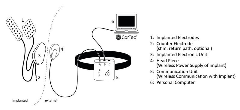 Schematische Darstellung der Komponenten des Cortec Brain Interchange Systems  (Bild: Coretec)