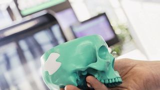 Abb.1: Ein wichtiges Anwendungsgebiet der additiven Fertigung sind individuell angepasste Implantate und Orthesen. Das medizinische PLA (Polylactid), das sich langsam im Körper abbaut, kann aktuell nur vom Freeformer verarbeitet werden.  (Arburg)